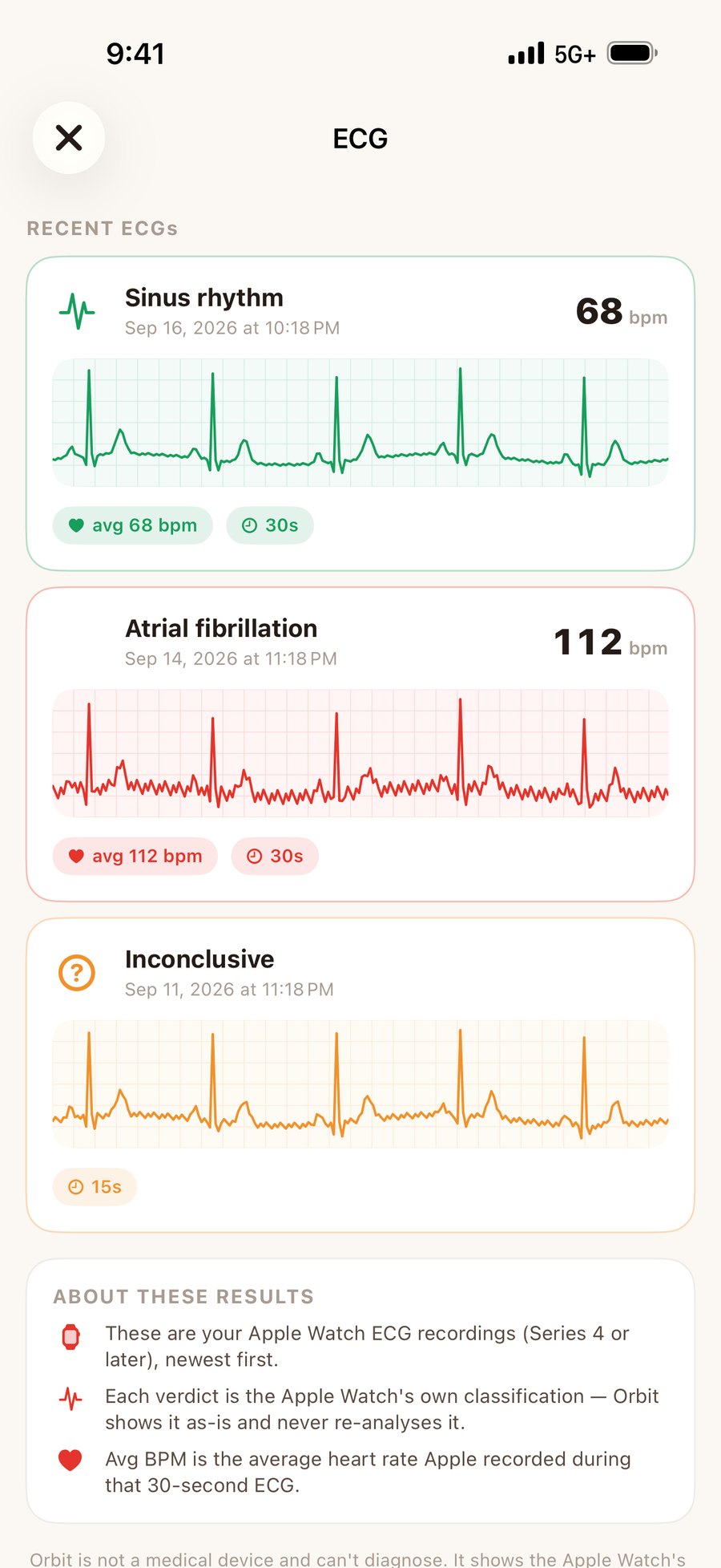 Orbit ECG history listing sinus rhythm, atrial fibrillation and inconclusive Apple Watch recordings